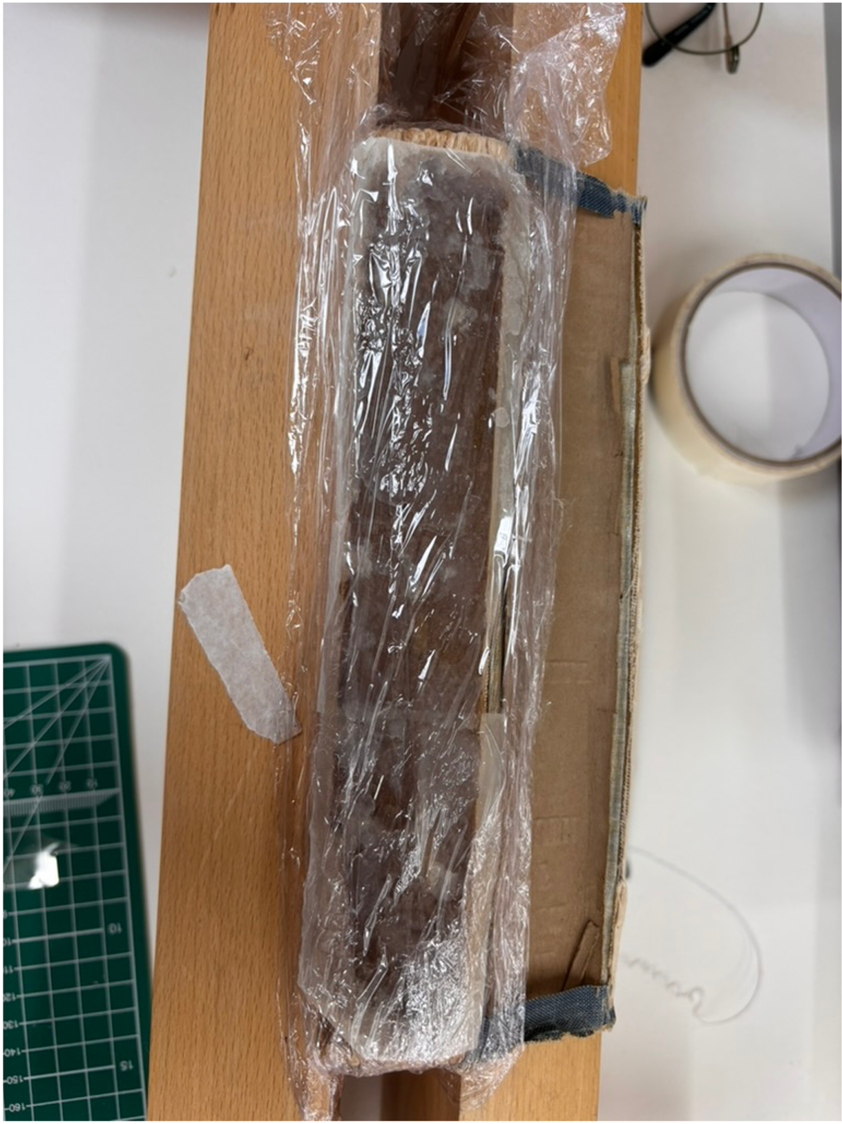 Spine Lining Investigation image 3